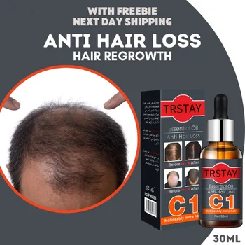 Spray para el cabello CULTIVADOR Producto de la Pérdida del Anti-pelo de Aceite Esencial -Suero de Crecimiento Crecimiento del Pelo para los Hombres