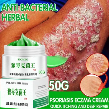Anti Crema de la Psoriasis y el Eczema Extractos de Hierbas, Antibacteriano Anti Picazón, Eliminar la Dermatitis, el Tratamiento Eficaz de los Productos